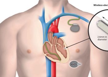 زراعة أجهزة تنظيم ضربات القلب وانتشار المخدرات.. دراسة تكشف العلاقة بينهم 2