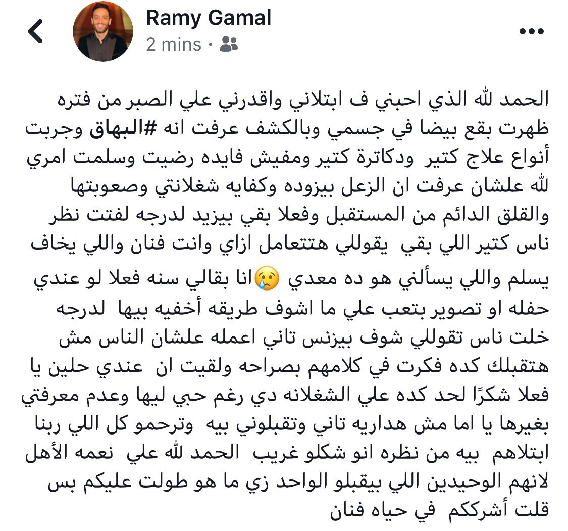المطرب رامي جمال يصاب بالبهاق.. يستشير جمهوره في تقبله بالمرض او الاعتزال 2