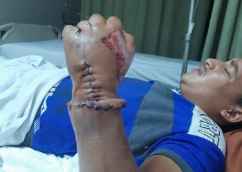 عودة "يد" مبتورة من ذراع شاب في حادث سيارة بأسيوط 7