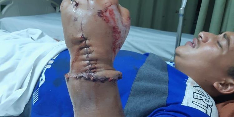 عودة "يد" مبتورة من ذراع شاب في حادث سيارة بأسيوط 1