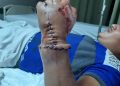 عودة "يد" مبتورة من ذراع شاب في حادث سيارة بأسيوط 6