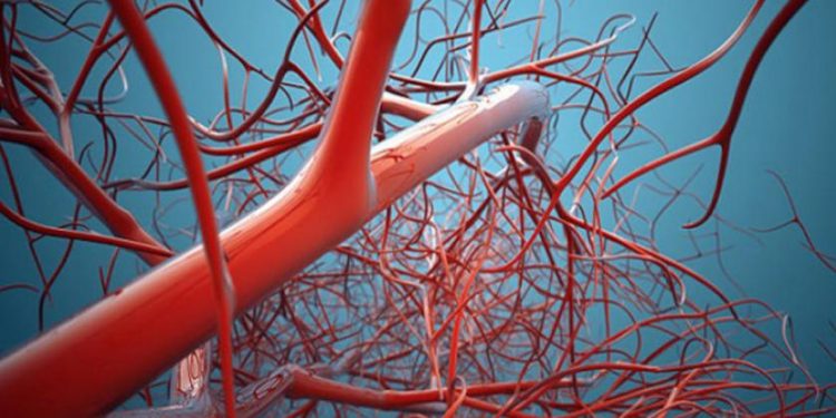 دراسة: مرض الأوعية الدموعية إشارة خطيرة لأمراض الأورام 1