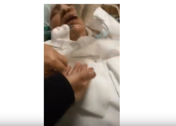 فيديو.. ديدان تخرج من جهاز تنفس مريض بالمستشفى.. والصحة تبحث عن السبب 6