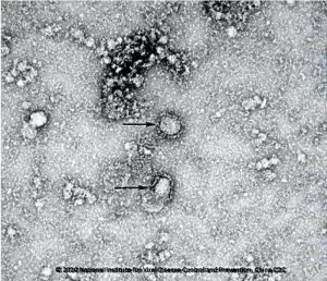 تم التقاطها بواسطة مجهر إليكتروني.. الصين تنشر الصور الاولي لفيروس كورونا الجديد 1