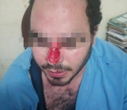 الاعتداء على طبيب الطوارىء بمستشفي "طنطا الجامعي" وإصابته 1