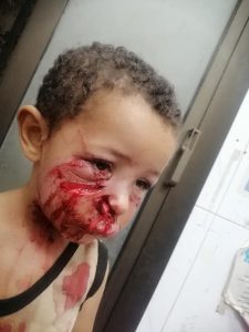 «صور مؤلمة».. كلب ينهش طفلًا في محافظة الجيزة 2