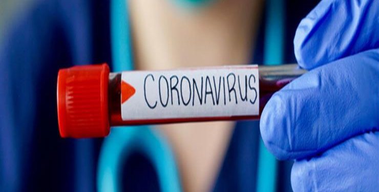 روسيا تعلن رسميا أنتاج أول دفعة للقاح كورونا للتداول فى العام 1