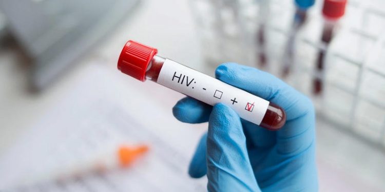 لمرضى الإيدز.. عقار جديد يقضي على تكاثر الفيروس بشكل نهائي 1