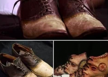 أحذية من جلد البشر