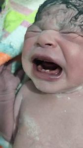 في حالة نادرة.. سيدة تضع مولودًا لديه «أسنان» في إحدى مستشفيات سوهاج (صور) 2