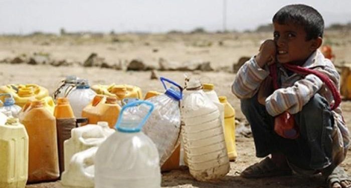 مجاعة الاطفال في اليمن