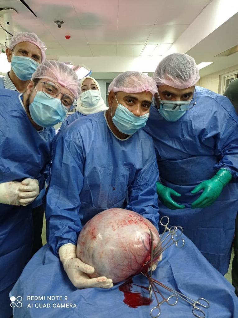 أطباء سوهاج الجامعي ينقذون فتاة بعد استئصال ورم بلغ وزنه 15 كجم (صورة) 1