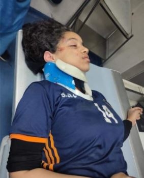 اصابة لاعبة كرة قدم صدمتها سيارة بمصر الجديدة