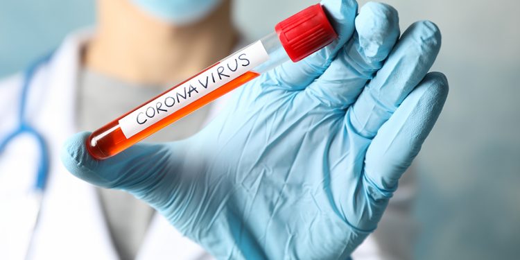 Doctor in protective mask holds positive blood test on Coronavirus. Healthcare and medical concept