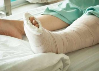 إصابة طالبة بكسر في القدم بعد سقوطها من شرفة شقتها بالمرج