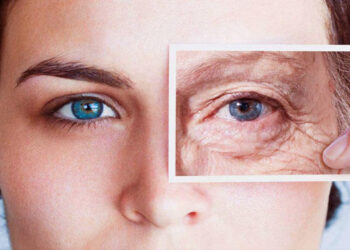 علاج تجاعيد العين.. أهم الوصفات الطبيعية لإزالة التجاعيد 7