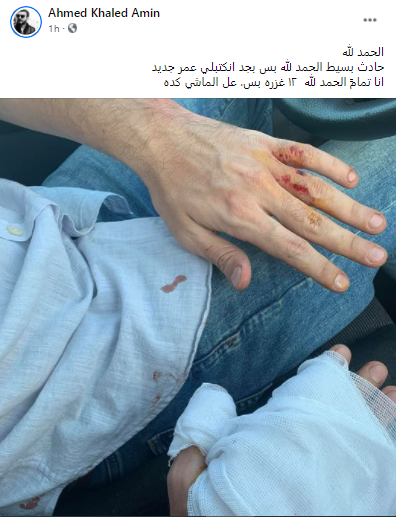 المخرج أحمد خالد أمين يتعرض لحادث ويعلق: "12 غزره بس.. على الماشي كده" (صورة) 1