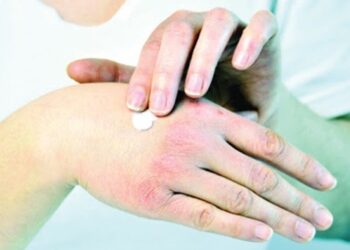 تجنب مشاكل جفاف الجلد في فصل الشتاء| نصائح صحية 3