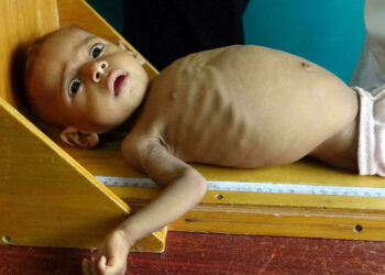 «ضاع العدل في بلد العرب».. الأمم المتحدة: 69 مليون عربي معرضين إلى مجاعة 3