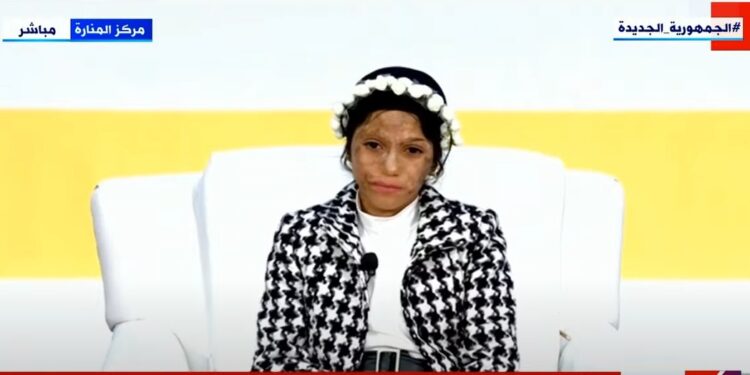 السيسي يطلب من وزير الدفاع اصطحاب طفلة من «ضحايا الحروق» في رحلة جوية خاصة  1