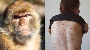 بعد انتهاء حالة الطوارئ العالمية.. الصين تسجل 1000 حاجة جديدة بمصابة بـ جدري القرود
