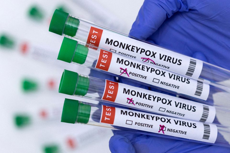 فيروس جدري القرود.. بعد اكتشاف أول حالة في مصر إليك أعراضه وطرق الوقاية منه