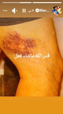 دخلت المستشفى.. شقيق ياسمين عبد العزيز يتعرض لحادث سير |صور 3