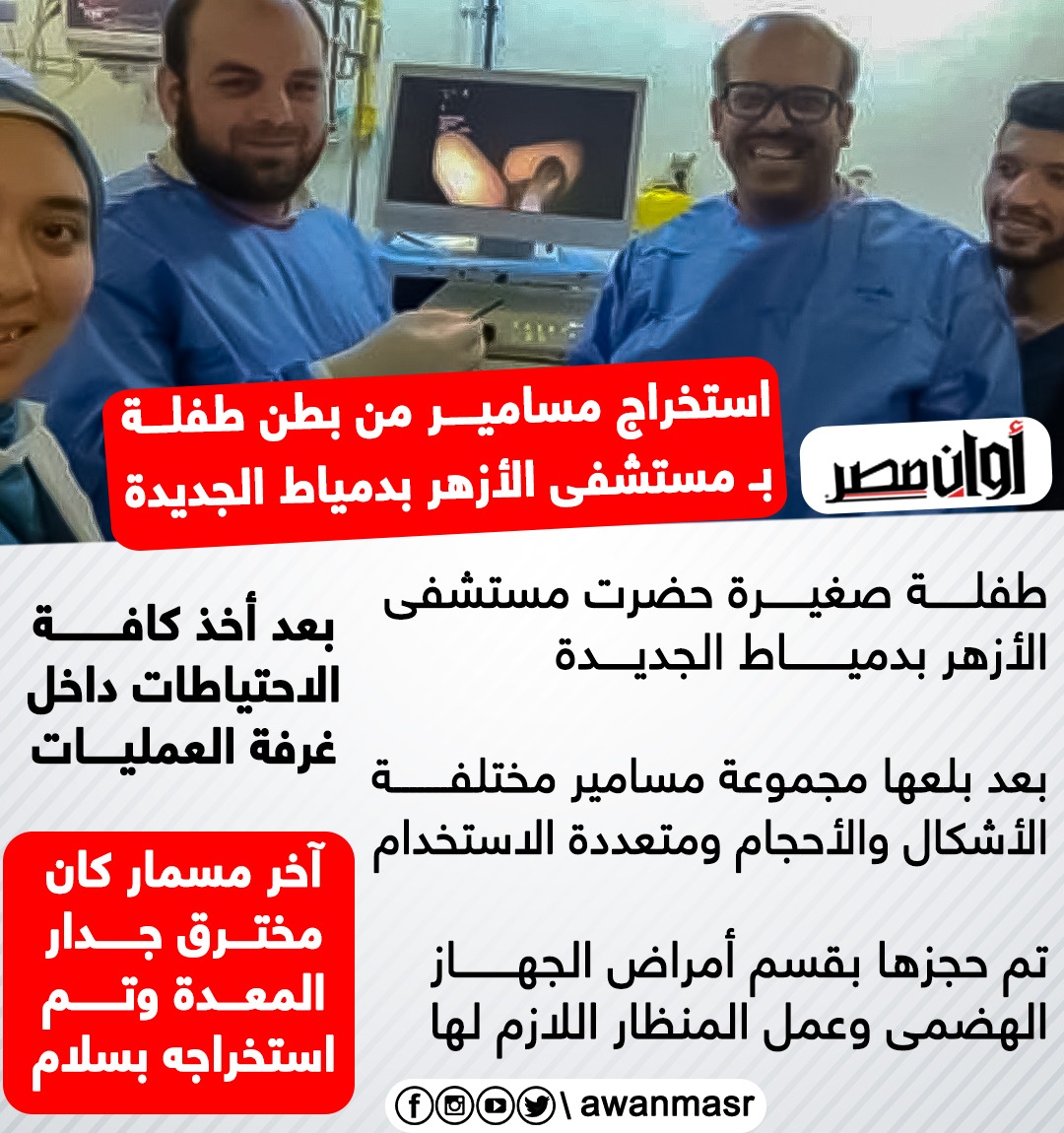 كان مخترق جدار المعدة.. استخراج مسامير من بطن طفلة فى مستشفى الأزهر بدمياط الجديدة 2
