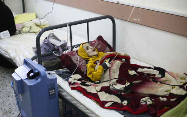 الإحصاء الفلسطيني:ارتفاع حالات الوفاة بسبب سوء التغذية في قطاع غزة 1