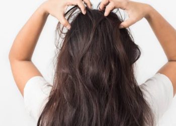 لعلاج الهرش والحكة.. وصفات طبيعية تخلصك من قشرة الشعر 5