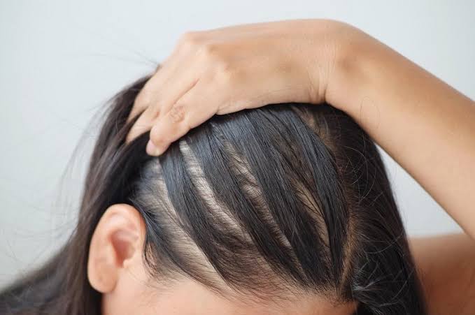 لو عندك فراغات في شعرك.. 7 خطوات لتكثيف البصيلات 4